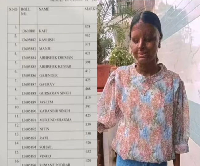 CBSE Topper Acid Attack Survivor kafi