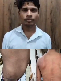 youth accused inspector of brutally beating him
