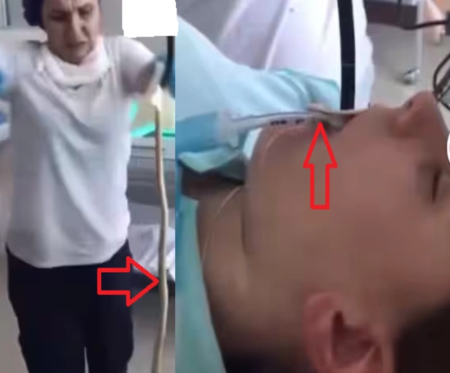 woman swallowed live snake while sleeping