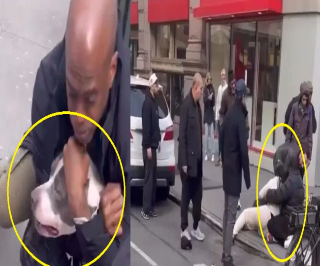 Pitbull attack on child