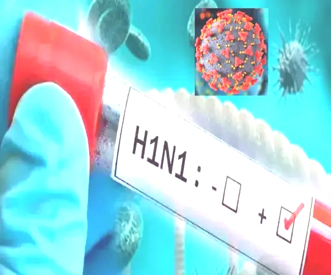 H1 N1